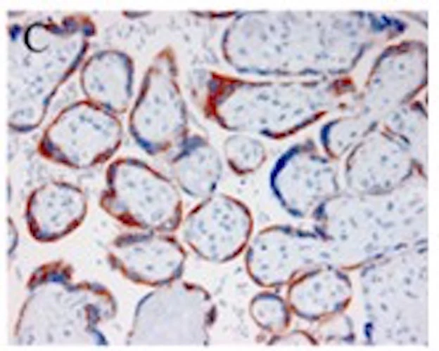 Anti-Pregnancy Associated Plasma Protein A (PAPP-A) Antibody