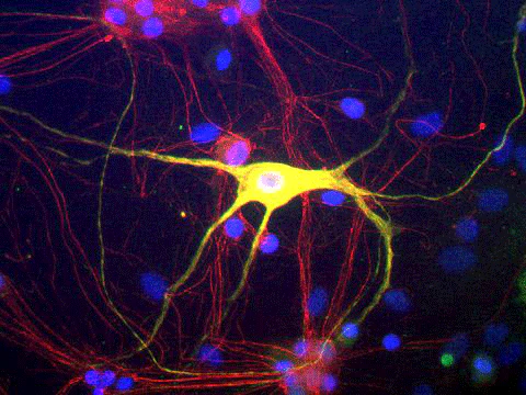 Anti-Peripherin Antibody - Image 2