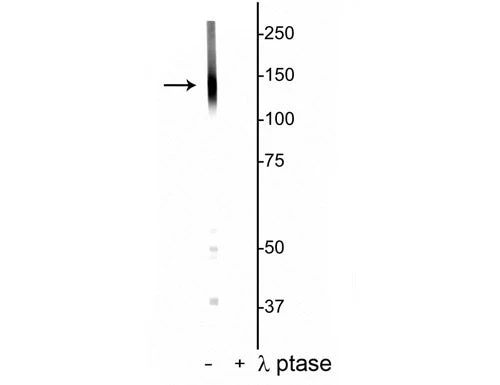 Anti-Potassium Chloride Cotransporter (KCC2) (Thr1007) Antibody