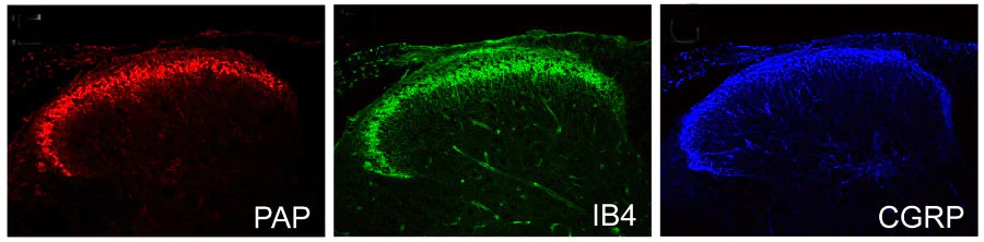 Anti-Prostatic Acid Phosphatase (PAP) Antibody - Image 2