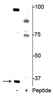 Anti-REDD1 (Thr23/25) Antibody