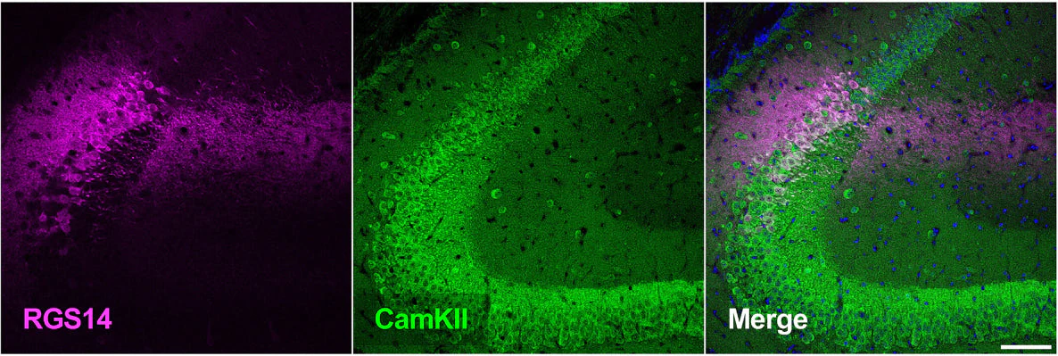 Anti-RGS14 Antibody - Image 2