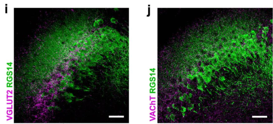 Anti-RGS14 Antibody - Image 7