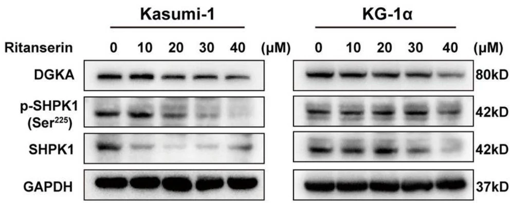 Anti-Sphingosine Kinase 1 (C-terminal region) Antibody - Image 2