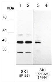 Anti-Sphingosine Kinase 1 (Central region) Antibody - Image 2