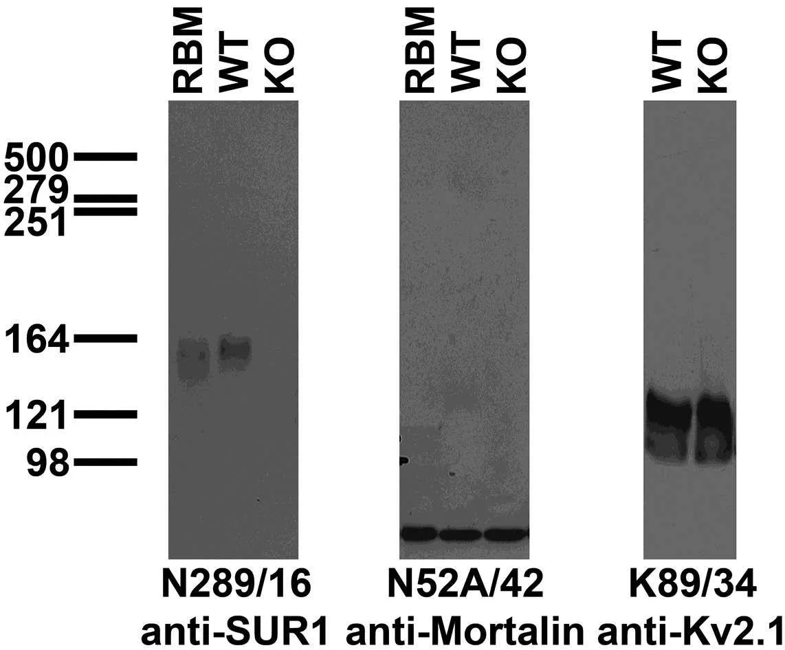 Anti-SUR1 Antibody - Image 3