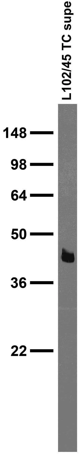 Anti-SynDIG4 Antibody - Image 2