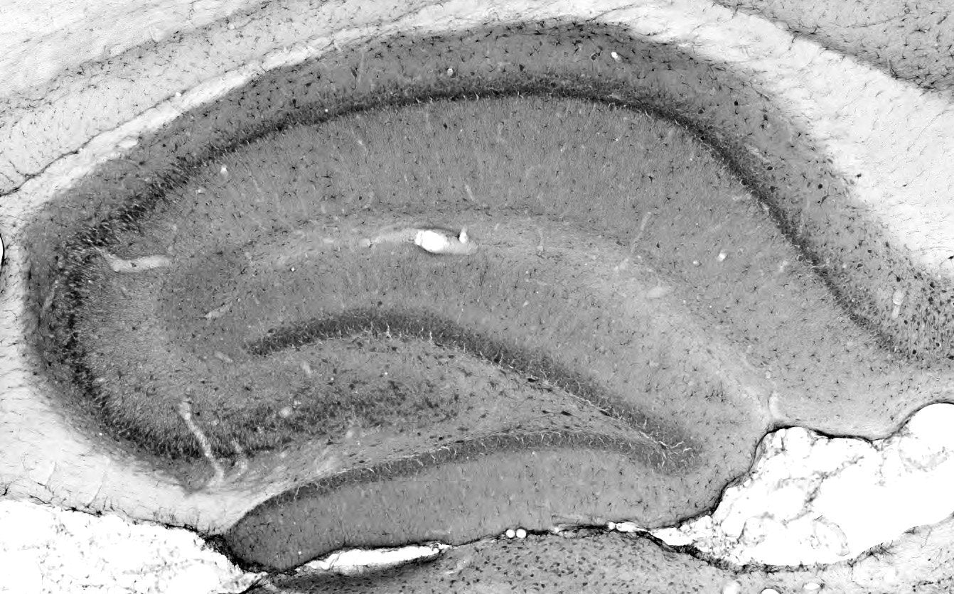 Anti-TALK1 Potassium Channel Antibody