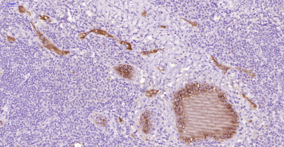 Anti-TAT (Thrombin-antithrombin) Antibody