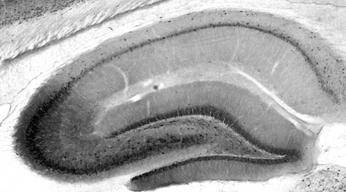 Anti-TrpC5 Antibody - Image 2