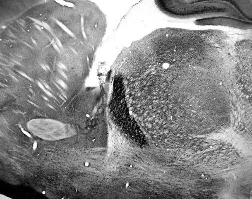 Anti-TrpC5 Antibody - Image 5