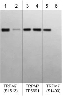 Anti-TRPM7 (Ser-1513), Phosphospecific Antibody