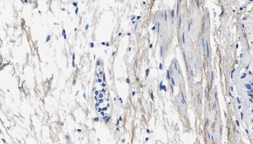 Anti-Type III Collagen Antibody