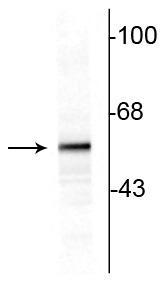 Anti-Tyrosine Hydroxylase Antibody - Image 2