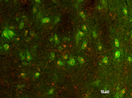 Anti-Tyrosine Hydroxylase Antibody (Purified)