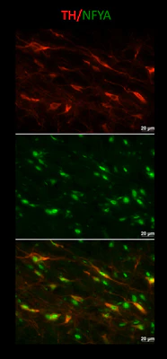 Anti-Tyrosine Hydroxylase Antibody (Purified) - Image 4