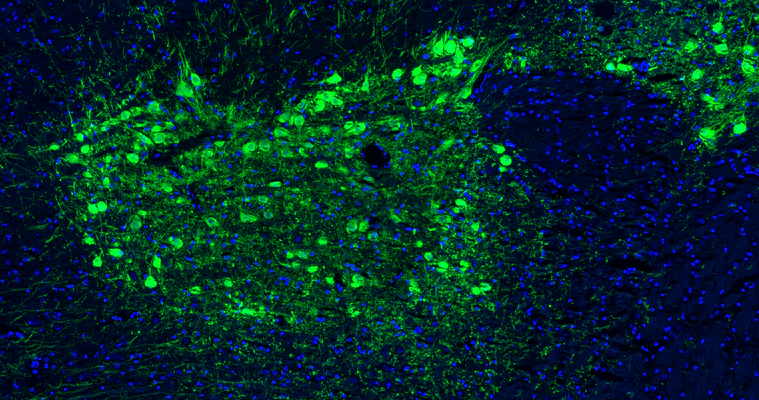 Anti-Tyrosine Hydroxylase Recombinant Chicken Chimeric mAb