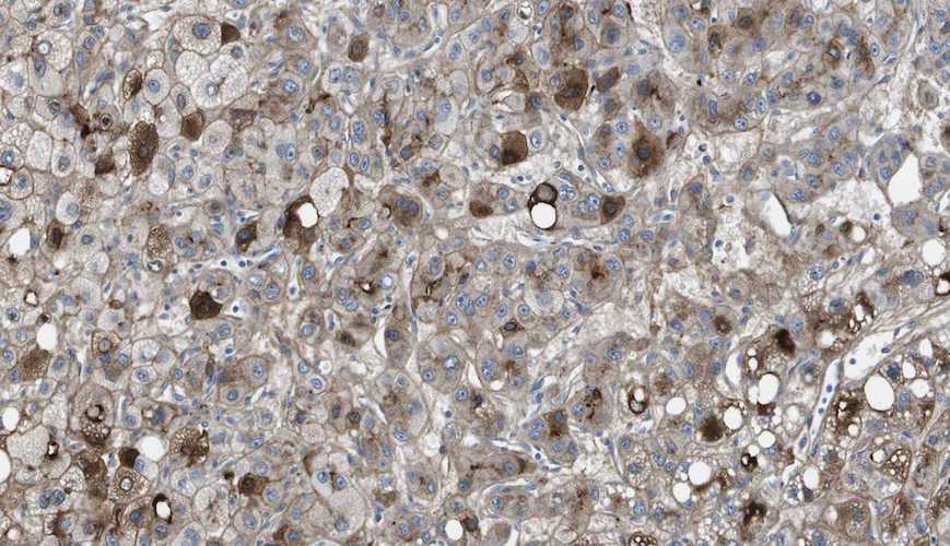 Anti-Vitronectin Antibody