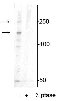 Anti-Xin Actin-binding Repeat-containing Protein 1 (XIRP1) (Ser295) Antibody