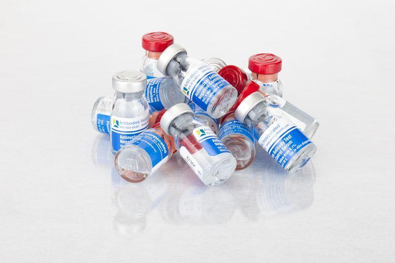 Centromere Positive Control In-Vitro Diagnostic Kit