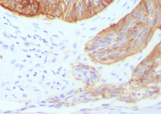 AEC Peroxidase Chromogen Substrate Kit