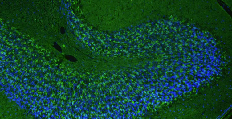 Goat Anti-Chicken IgY (H&L) Secondary Antibody, FITC