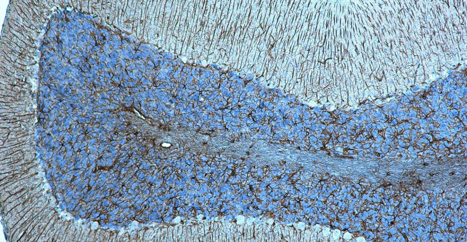 Immuno Protein Blocking Solution with Goat Serum - Image 5