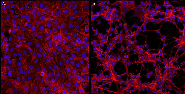Nerve growth factor (2.5S), Mouse, Purified Native Protein
