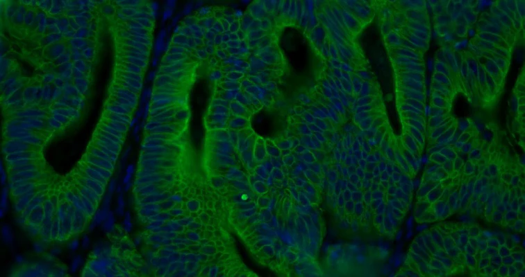 Universal Antibody Dilution Buffer,™ MIT-HCl - Image 2